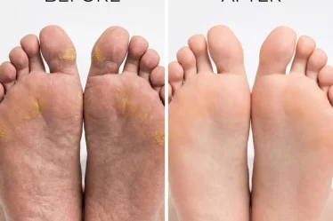 DIY Japanese Foot Detox Recipe What It Does and How to Make It at Home